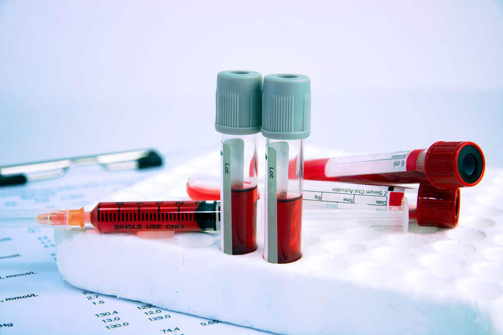 Kontrola hemoglobiny jest konieczna, by wykluczyć stan anemii.