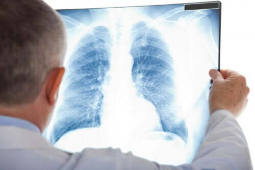 Nietypowe zapalenie płuc – co to za choroba?