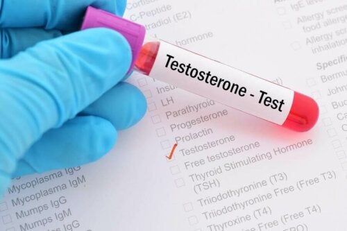 Co to jest zespół niedoboru testosteronu?