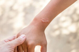 Pasożyty zewnętrzne - czym są pchły i roztocza?