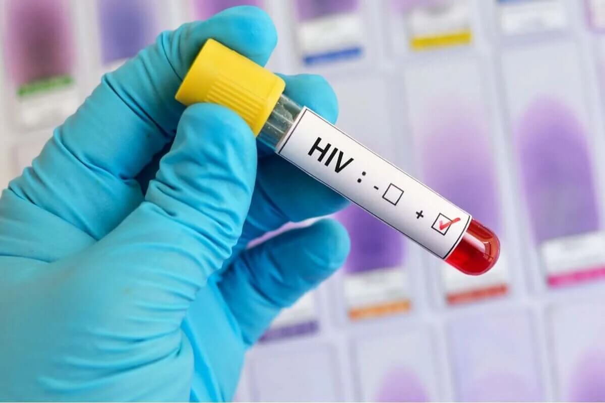 Przenoszenie wirusa hiv
