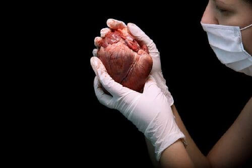 Na czym polega przeszczep serca i jakie są jego etapy?