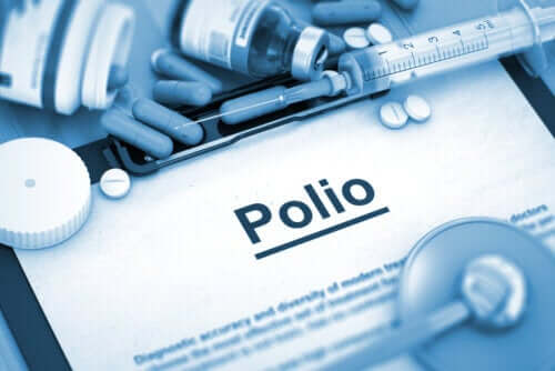 Polio lub ostre nagminne porażenie dziecięce - rodzaje
