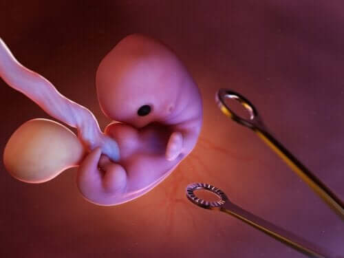 Aborcja: jak wygląda i co powinieneś o niej wiedzieć?