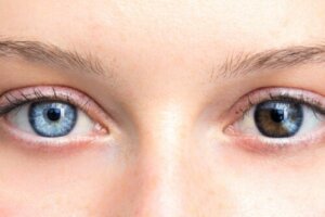 Zmiany koloru oczu mogą być niepokojące