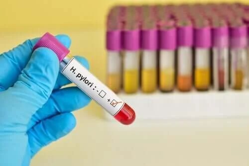 Badanie na obecność Helicobacter pylori