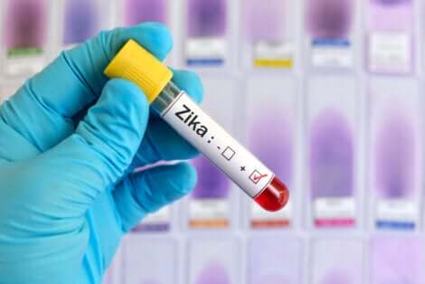 Epidemie zika zostawiły ślad na historii epidemiologii.