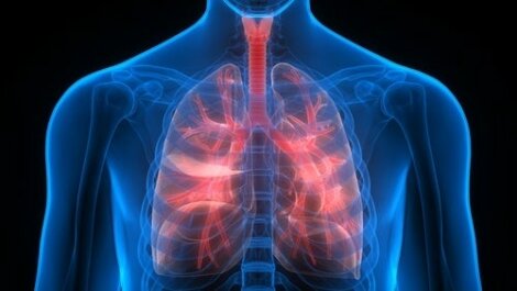Przeszczep płuc – wszystko, co musisz wiedzieć