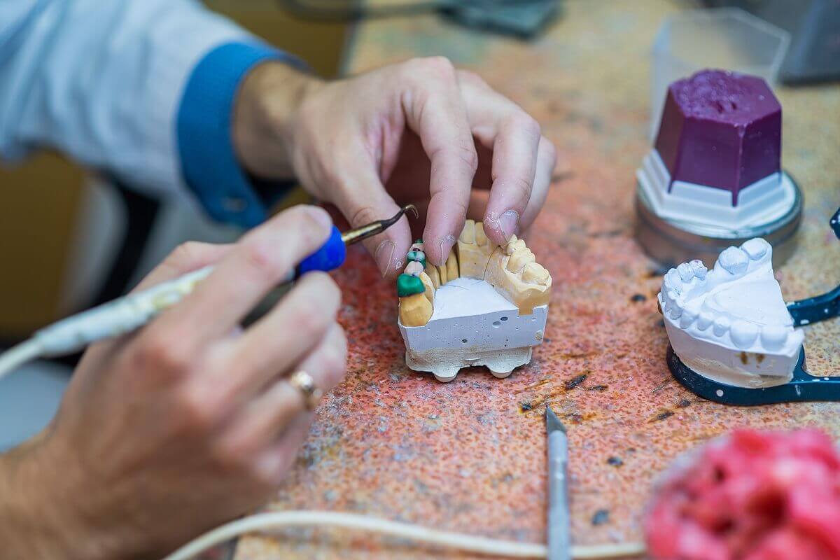 Mostek uzupełnia brakujące zęby.