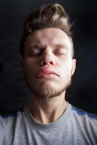 Obrzęk Quinckego - przyczyny i objawy