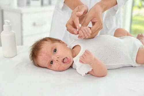 Trądzik niemowlęcy: przyczyny i leczenie