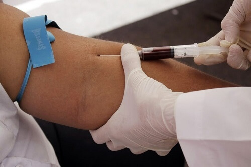Hiponatermia - badanie krwi