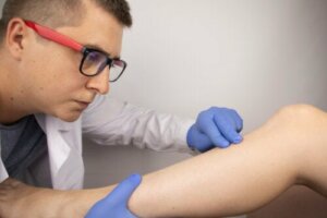 Stłuczenie kości: przyczyny, objawy i leczenie