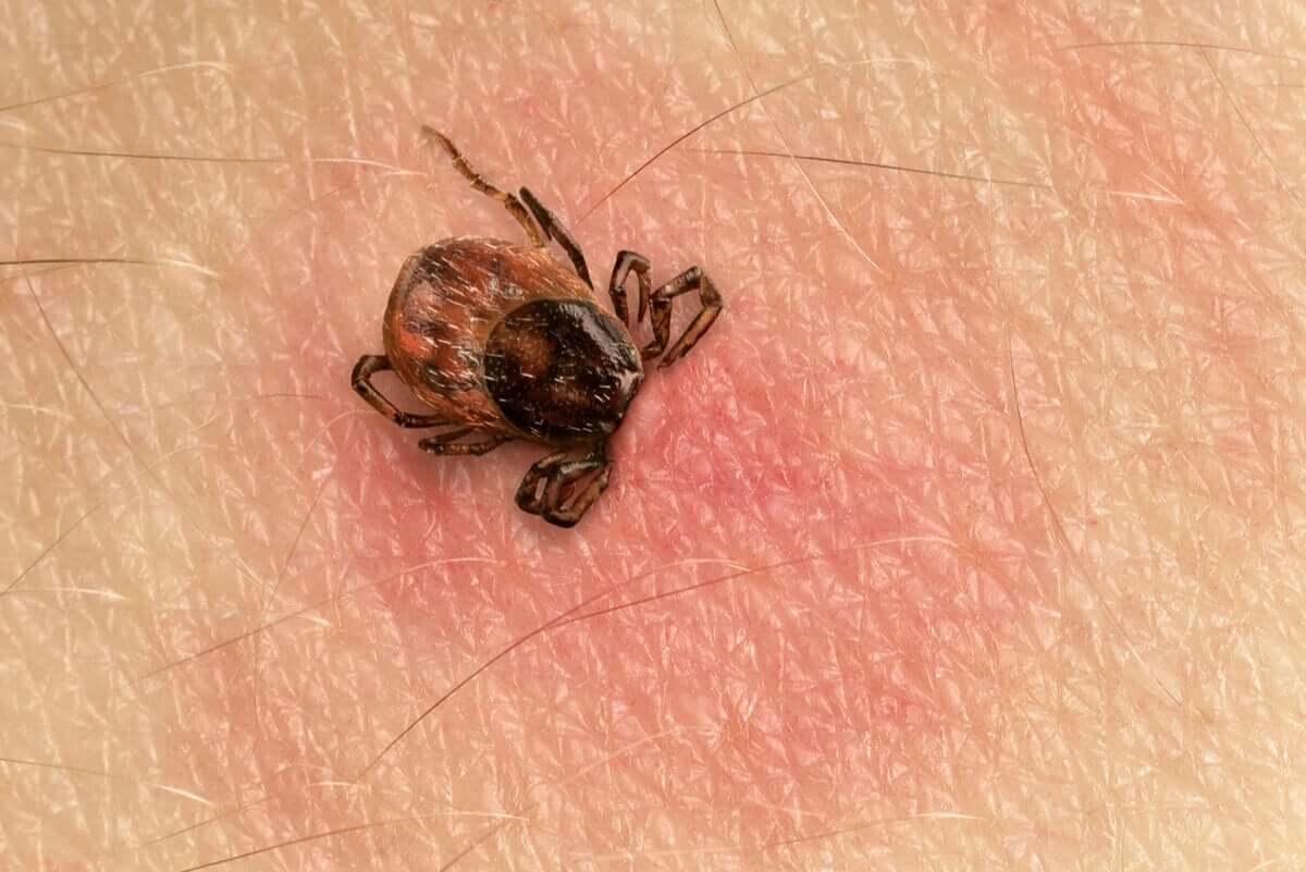 Kleszcze są odpowiedzialne za występowanie zespołu alfa-gal.