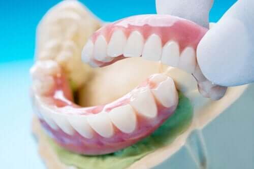 Most dentystyczny — charakterystyka ogólna i sposób wykonania