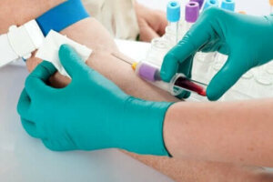 Hiperpotasemia: poznaj jej objawy i przyczyny
