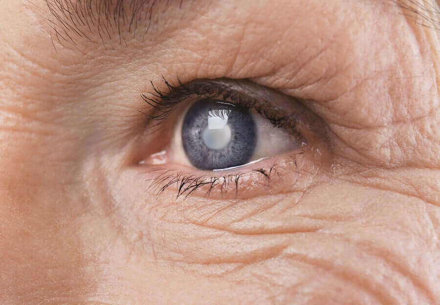 Retinopatia cukrzycowa - jak cukrzyca wpływa na wzrok?