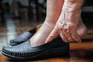 5 sposobów na spuchnięte nogi w upalne dni