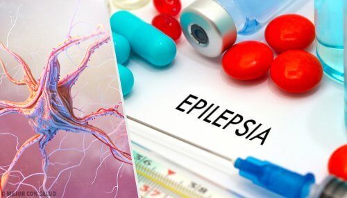 Niekontrolowane ataki śmiechu lub płaczu to odmiana epilepsji.