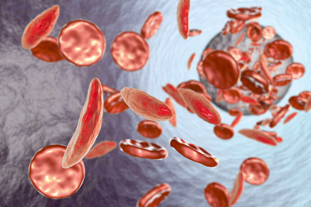 Przy anemii Fanconiego organizm nie wytwarza dostatecznej liczby czerwonych krwinek.