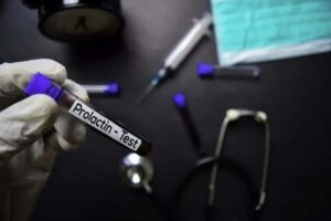 Normalne poziomy prolaktyny i powody, przez które mogą się zmieniać