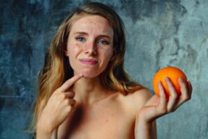 Alergia na cytrusy: objawy, leczenie i zalecenia