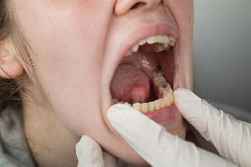 Rak jamy ustnej: czynniki ryzyka