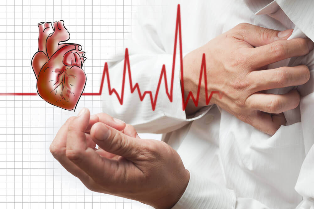 EKG