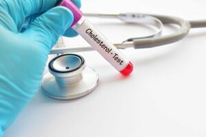 Jaki jest prawidłowy poziom cholesterolu?