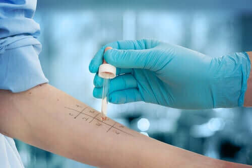 Testy skórne - alergia na penicylinę