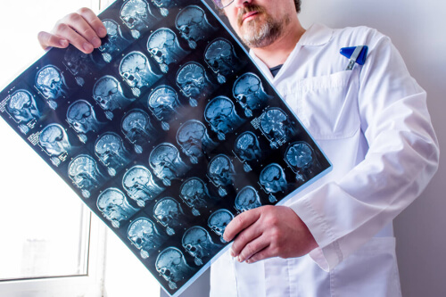 Tomografia komputerowa mózgu