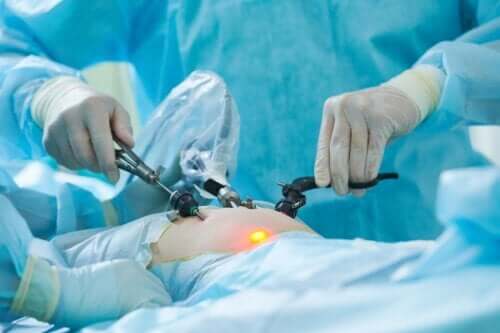 Czym jest laparoskopia i na czym ona polega?