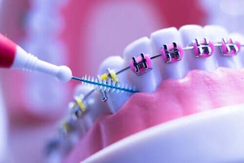 Ortodoncja - 8 wskazówek skutecznego leczenia