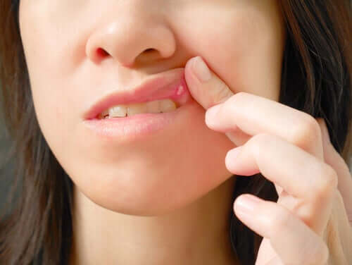 Rany w jamie ustnej: przyczyny i leczenie