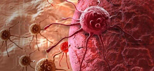 Możliwe oznaki raka u mężczyzn i kobiet