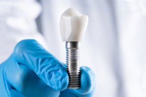 Periimplantitis: przyczyny, objawy i zapobieganie