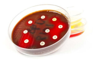 Antybiogram - co to jest i jakie są jego zastosowania?