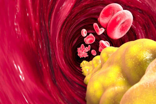 Cholesterol