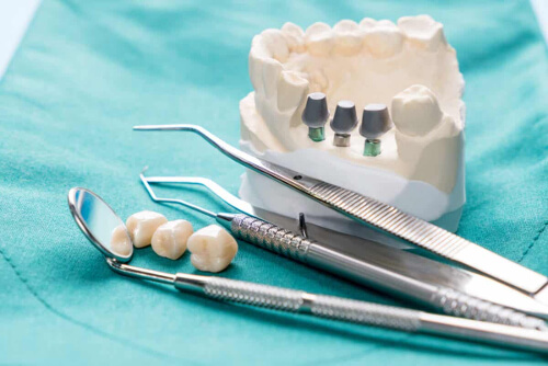 Chirurgia dentystyczna