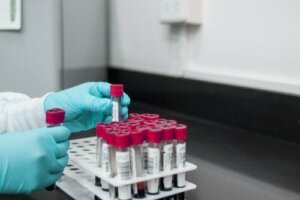 Szybki test reaginy w osoczu do diagnozy kiły