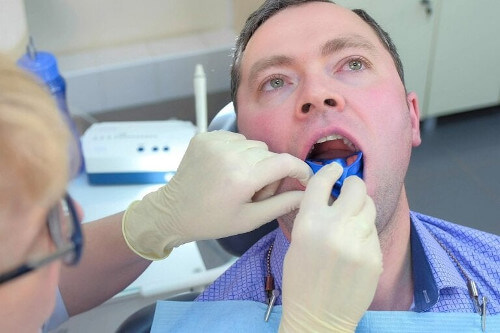 Fluor dentystyczny – jak pomaga na próchnicę