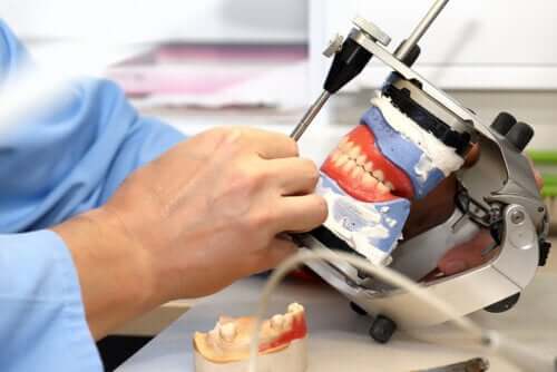 Protetyka implantów dentystycznych - czym jest i jakie są jej rodzaje