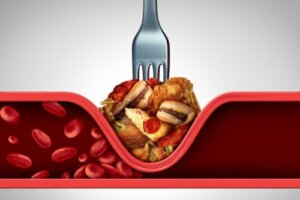 9 strategii, które pomogą Ci obniżyć poziom cholesterolu