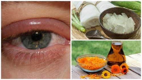 Zwalczaj infekcje oczu jednym z tych 9 środków zaradczych