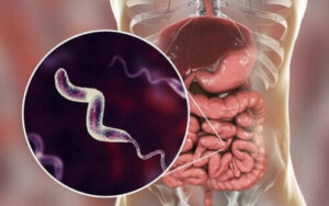 Charakterystyka infekcji Campylobacter