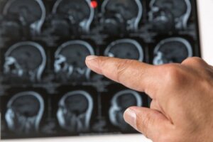 Czy guzki na głowie mogą oznaczać guzy?