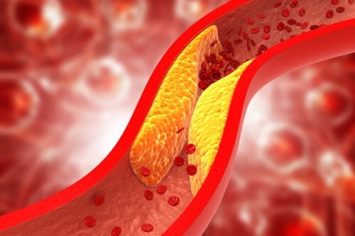 Czy dieta ketogeniczna zwiększa poziom cholesterolu?