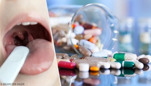 Ostre zapalenie migdałków - jak je wyleczyć?