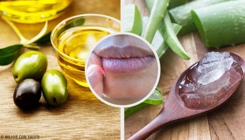 Wylecz spalone usta naturalnymi lekami