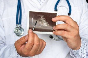 Co to jest guz chromochłonny i jakie są jego objawy?